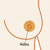 Aerola