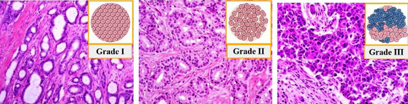 Grade