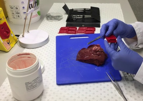 histopathology