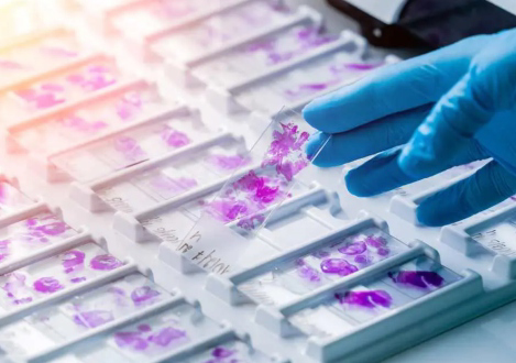 histopathology