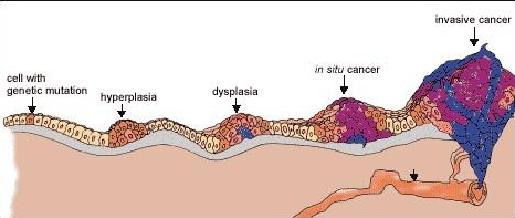 IN SITU